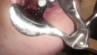 Nipple and anal torment with thumbtacks