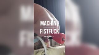 Fistfuck Machine with Arnies Extremity Xlarge